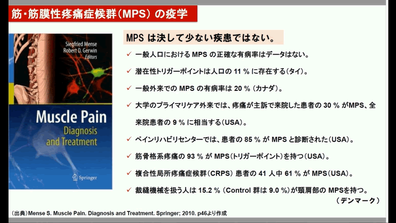 解説動画］筋・筋膜性疼痛症候群（MPS）の疫学｜トリガーポイントとは
